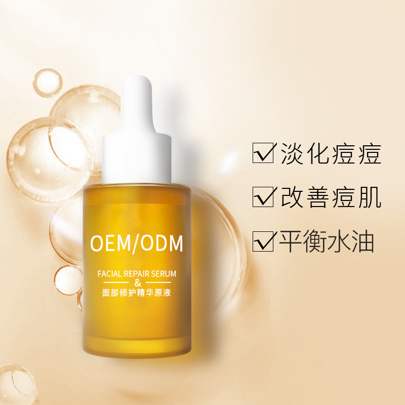 颜尚_祛痘精华原液OEM